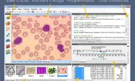 Intelligence Artificielle : Evolucare rachète ADCIS