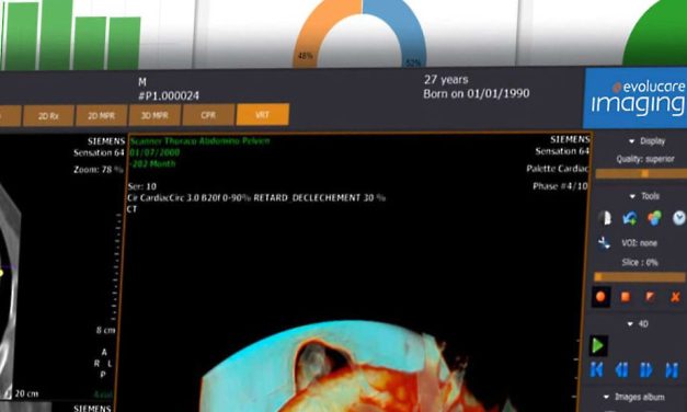 Imagerie : la solution Imaging d’Evolucare référencée Ségur