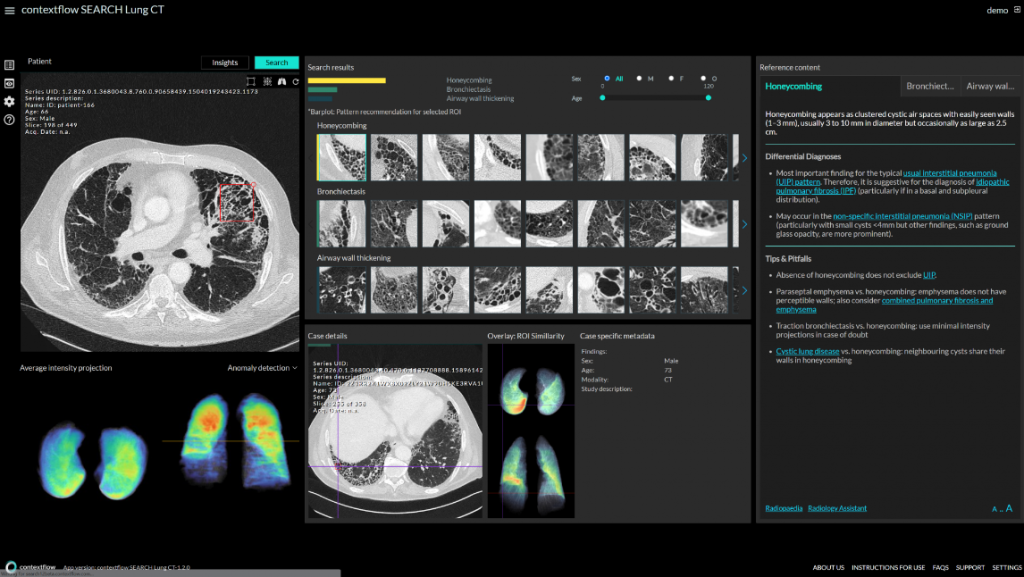 SEARCH Lung SOFTWAY MEDICAL