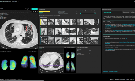 SOFTWAY MEDICAL : Un partenariat avec CONTEXFLOW en imagerie médicale