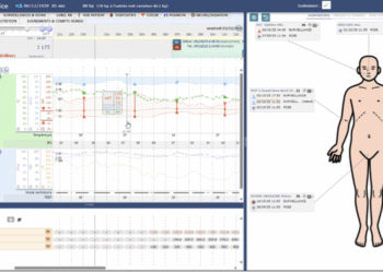 MÉDECINE INTENSIVE ET RÉANIMATION : DES SYSTÈMES SYNONYMES DE PRÉCISION ET DE RÉACTIVITÉ