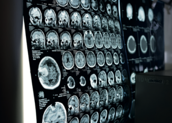 La radiologie d’urgence, pilier stratégique d’un système de santé sous tension