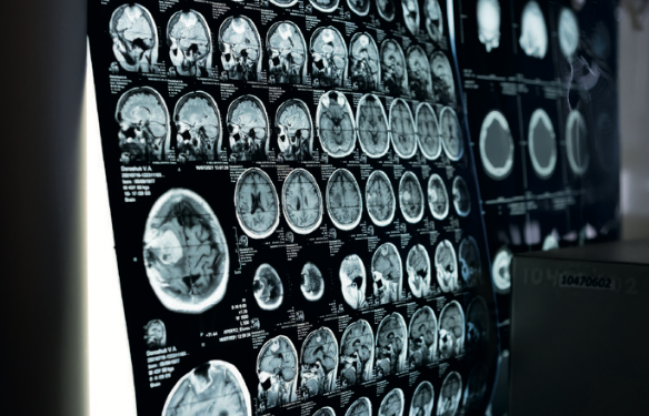 La radiologie d’urgence, pilier stratégique d’un système de santé sous tension