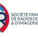 Programme IMPULSION : la SFR forme des radiologues au dépistage du cancer du poumon